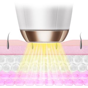 PSE Approval Handheld Laser Hair Remover IPL Skin Rejuvenation