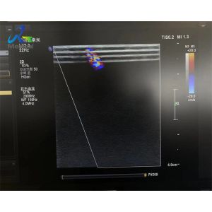 China  L12-3 Linear Array Ultrasound Transducer Probe Replace Strain Relief Crystal And Cable on sale