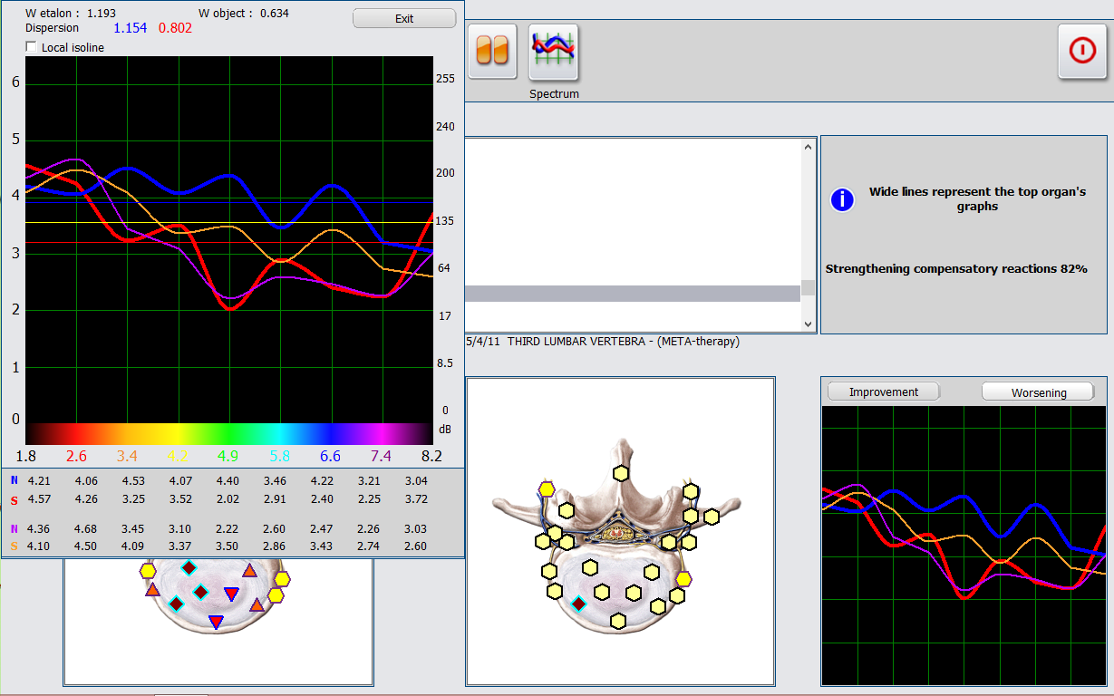 Biochemical Analysis Body Health Machine 95% Accuracy Nls Health Analyzer
