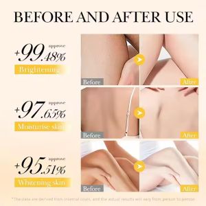 Turmeric Vitamin C Whitening Body Lotion Anti Acne Hydrating Brightening Body