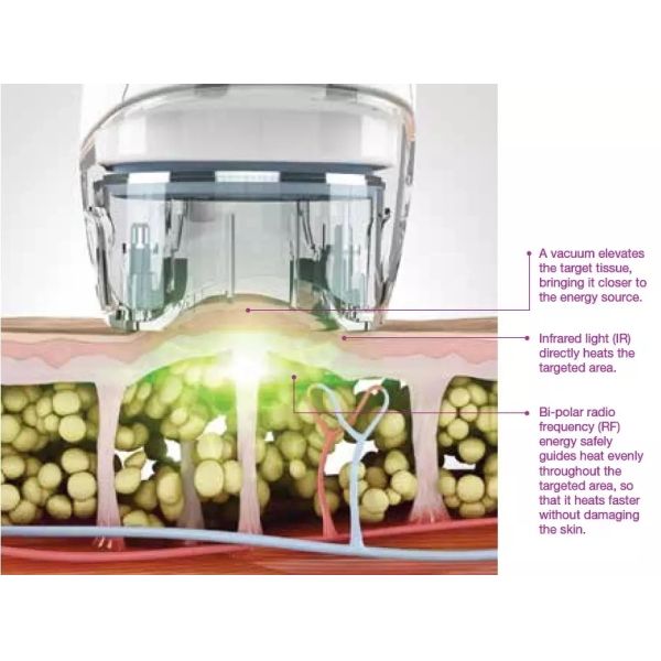 Portable 2in1 80Kpa Cavitation 2 Probes Body Slimming Vela Machine