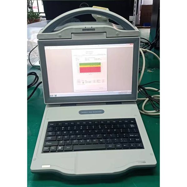 2022 New Arrival Medical Pediatrics Diagnostic Adult Child Ultrasonic Bone Density Scanner