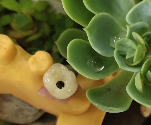 Buy Great Biocompatibility ANKYLOS Dental Implant Supported Crown at wholesale prices