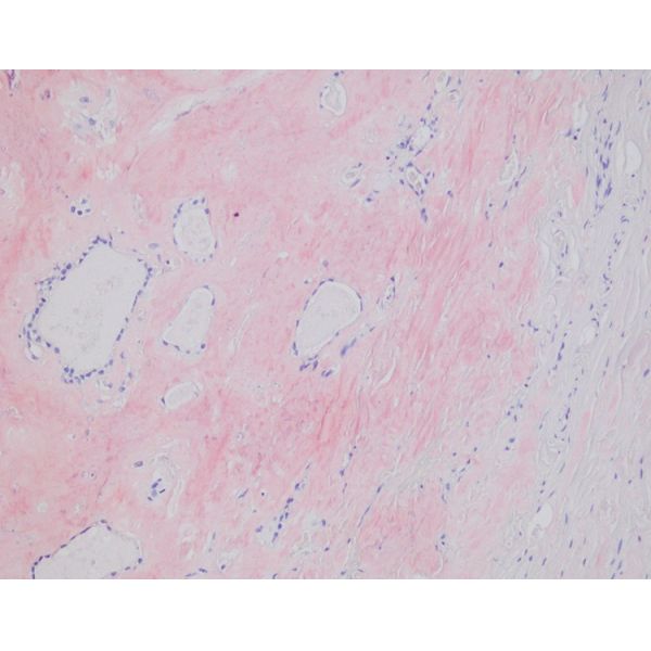 Congo Red Stain Kit For Hospital Medical Diagnosis 3x20ml 3x100ml