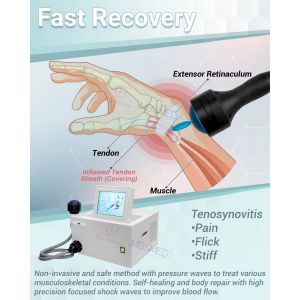 Shock Wave Therapy Equipment Erectile Dysfunction Shock Waves Focus Eswt