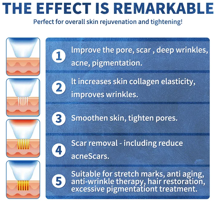 Fractional Microneedle RF Machine 25pins / 49pins For Wrinkle Removal Treatment