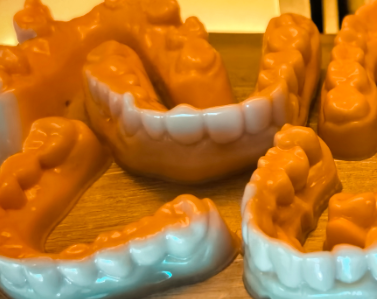 Model Resin Dental Intraoral Scan Customized Denture Base Educational Demonstration