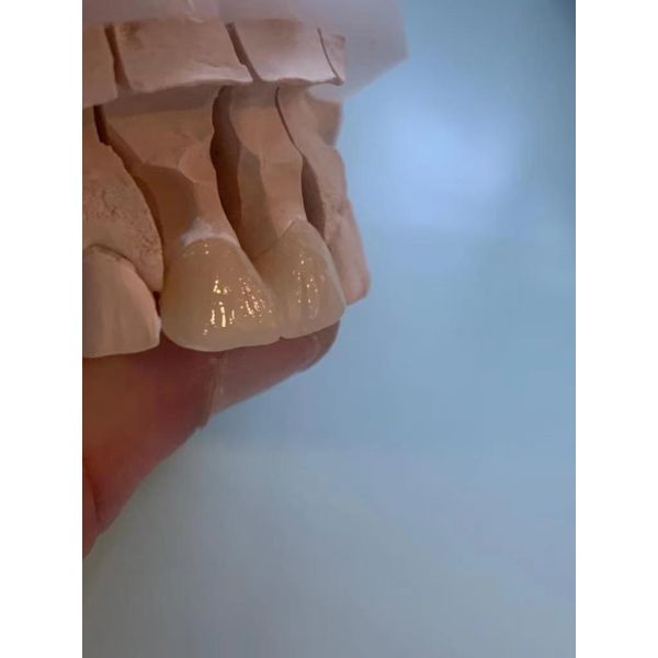 16 Colors Dental Lab Multilayer Zirconia Block 98*20mm 6.07g/cm³ Density