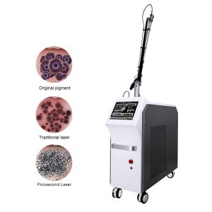 2000MJ 1064nm 532nm 755nm Q Switch Laser Tattoo Removal Machine