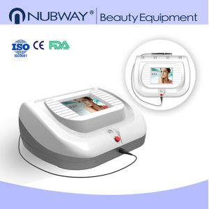 Big discount !!! 30MHZ salon or spa used skin tag and Spider Vein Removal Machine