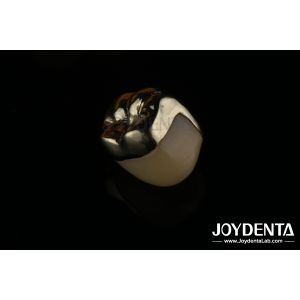 Oral Rehabilitation Wax Casting FMC Full Metal Crown For Dental Clinical Repair