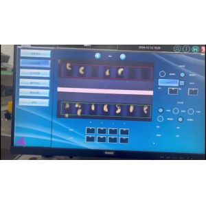 State-of-the-Art Cashew Kernel Sorting Equipment with Full 360° AI-Based Defect