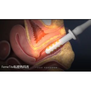 Non Surgical Therapy Vaginal Rejuvenation Radio Frequency For Clinical