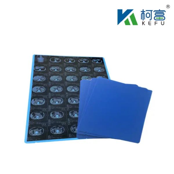 Medical X-ray Film Blue PET Based X Ray Thermal / Inkjet Film Medical Images For Clinic And Hospitals