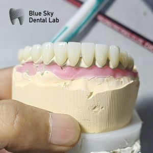 Customized Surgical Smooth Steam Sterilization Universal Compatibility Implant procedure cases