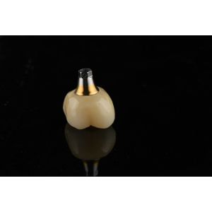 titanium 10mm Single Tooth Dental Implants Replacement Abutment Self Tapping