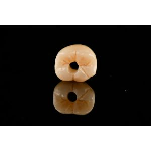 10mm Titanium Tooth Implant Sandblasted Self Tapping Dental Implants