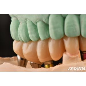 High Translucency Multilayered Full Contour Zirconia Natural looking 1200 HV