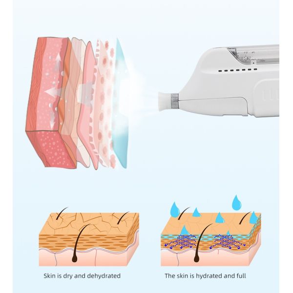 Non Invasive Moisturizer Skin Therapy 1mpa Facial Lifting Device