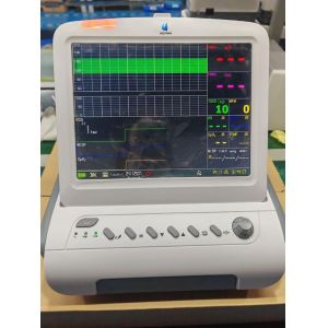 12'' CTG Maternal Fetal Monitor Perinatal Uterine Contraction Twin Monitoring