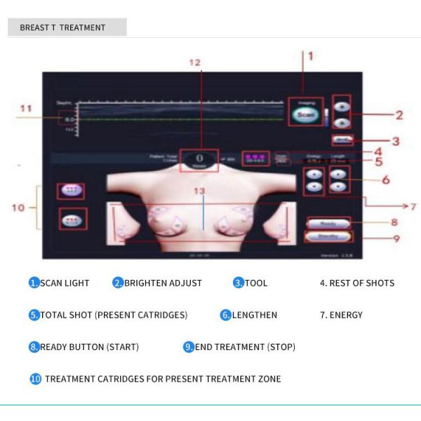 Liposonix Hifu Slimming Beauty Machine Portable For Salon Body Shaping 8mm 13mm