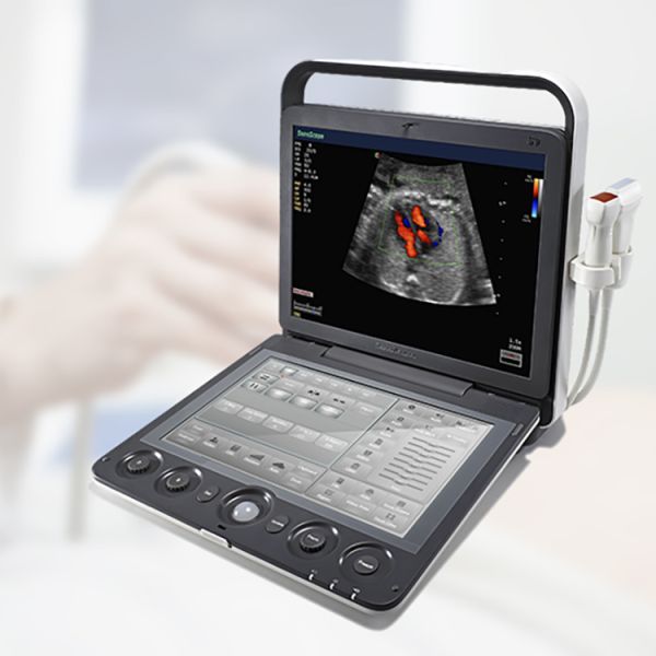 Sonoscape S9 Pregnant Baby Medical Diagnosis 4D Color Doppler Sonography Machine Portable Ultrasound