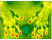 Uncooled FPA VOx 28.6mm Lens Thermal Fever Detector