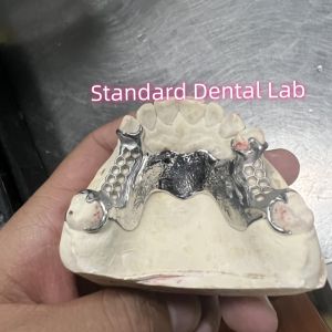 China Cobalt Chrome Cast Frame Partial Denture Vitallium 2000 on sale