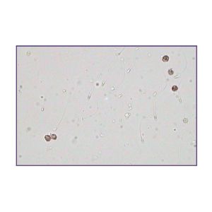 20Tests Semen Leukocytes Peroxidase Stain Kit Toluidine Method