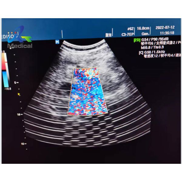 Buy Medison X6 Ultrasonic Board Repair Solutions Image Interference at wholesale prices