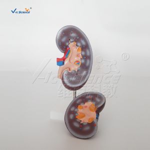 Medical Science Human Body Anatomy Model Human Kidney Model 20x10x7CM