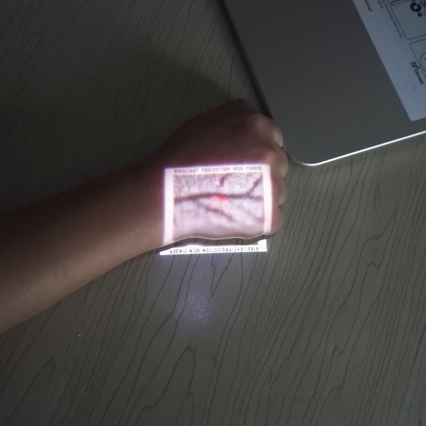 Medical Infrared Vein Finder Accurate for Projecting Human Skin Vein Imaging Device