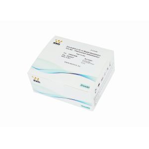 China IL-6 Interleukin 6 Test Kit Inflammation Detection 800 Tests/hour 25 Test Package on sale China IL-6 Interleukin 6 Test Kit Inflammation Detection 800 Tests/hour 25 Test Package on sale