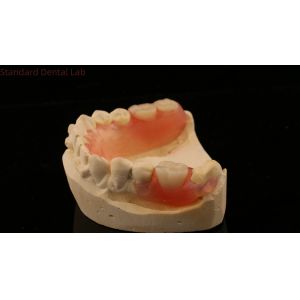 Dental TCS Valplast Flexible Partial Dentures Nesbit Valplast Finish China