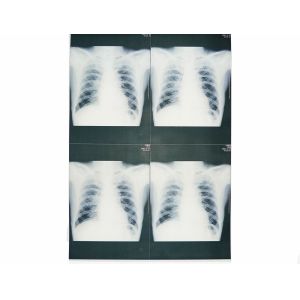 Wearable White Base Medical X Ray Films , Medical Imaging X-ray Paper Film