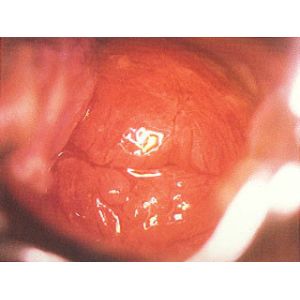 Handheld Video Digital Electronic Colposcope With High-Resolution 80,0000 Pixels