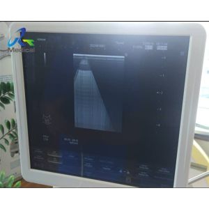 Hitachi Aloka Ascendus Image Shadow Ultrasound Machine Repair Replace TRX Board