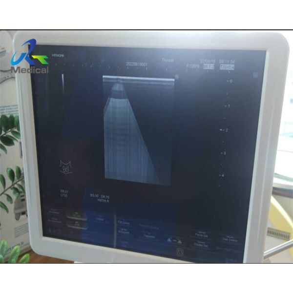 Buy Hitachi Aloka Ascendus Image Shadow Ultrasound Machine Repair Replace TRX Board at wholesale prices