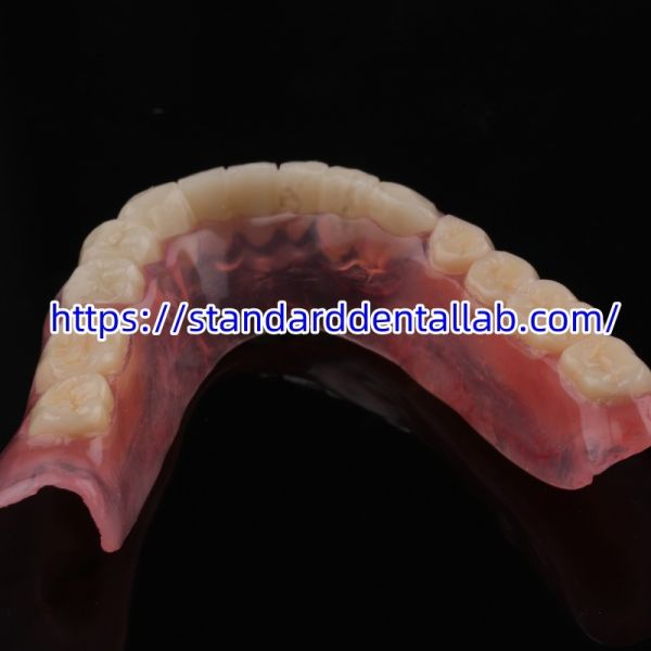 High Esthetics Dental TCS Valplast Flexible Partial Dentures Dental Lab Valplast Clasp Pink Shade