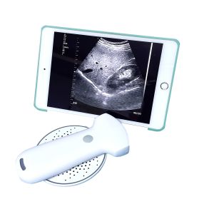 Affordable Ultrasound Equipment Wireless Convex Array Medical Probe MSLPU94