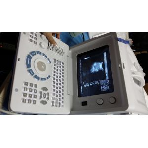 CLS-2180 Portable Ultrasound Scanner