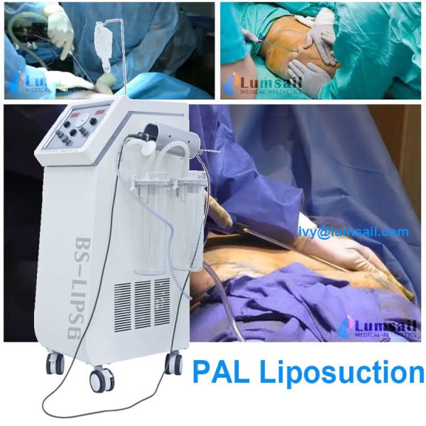 Buy Body Contouring PAL Power Assisted Liposuction System Aesthetic Surgeon at wholesale prices