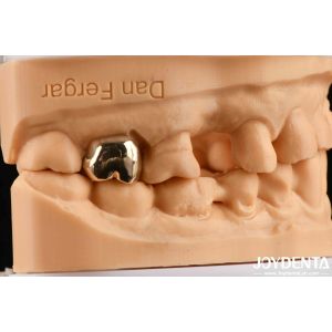 Abrasion Resistant Wax Casting Dental Materials for Enhanced Oral Rehabilitation
