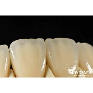 Bionic Development Leaves And Distinct Layers Of Zirconia All-Ceramic