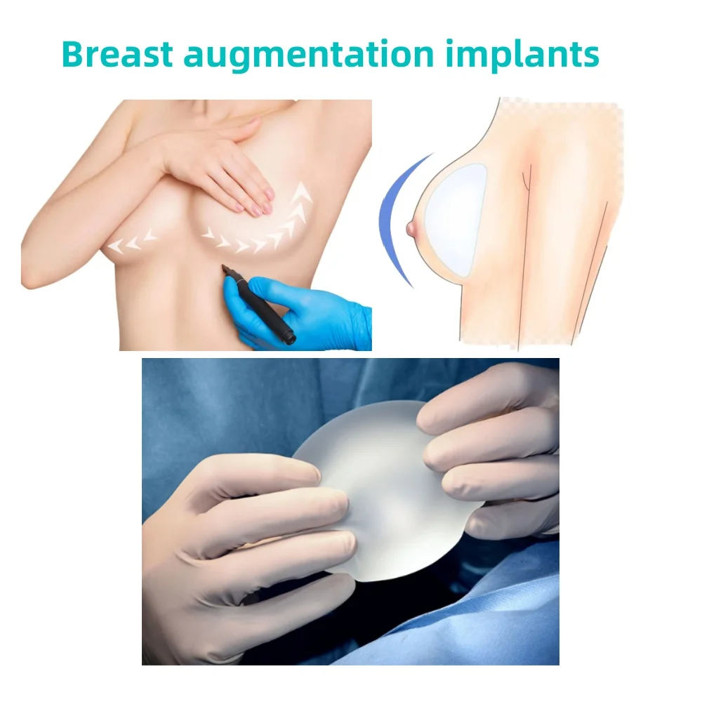 Medical Grade Bulk Squishy Silicone Gel Liquid Non Toxic Adhesive For Scar Patch