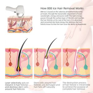 808nm Diode Laser Hair Removal Machine With 15.6 Inch Screen Size