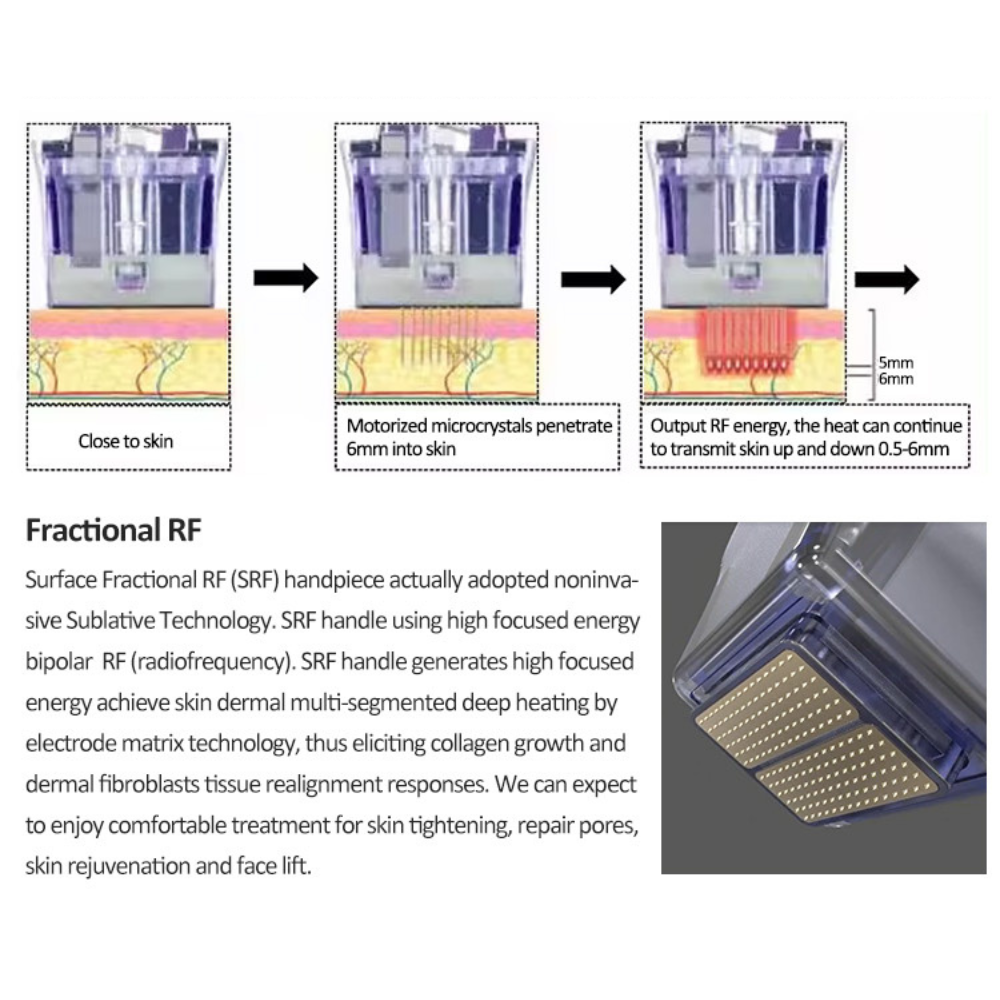 2 PCS Nano-L RF Heads Microneedle RF Device for Effective Face Lifting and Wrinkle Reduction Beauty Treatment