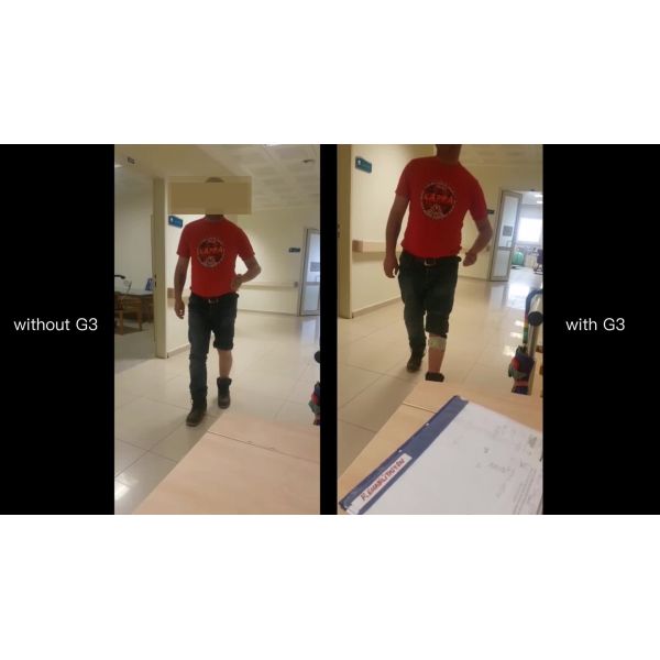 Hemiplegia MS Foot Drop Stimulator Walking Assist Improve Ground Clearance