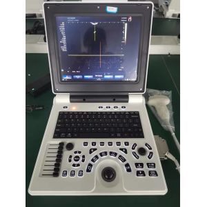 PW Ophthalmic Ultrasound Portable USG Machine Ultrasonography Machine