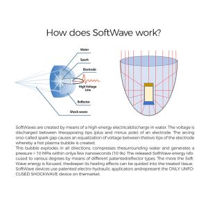 Physical Therapy Physiotherapy Pain Treatment Eswt Shock Wave Dual Handles